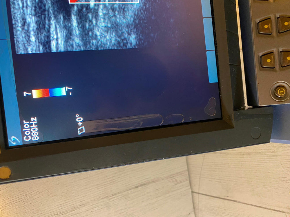 
                  
                    Sonosite MicroMaxx Portable Ultrasound 2007- Main unit
                  
                