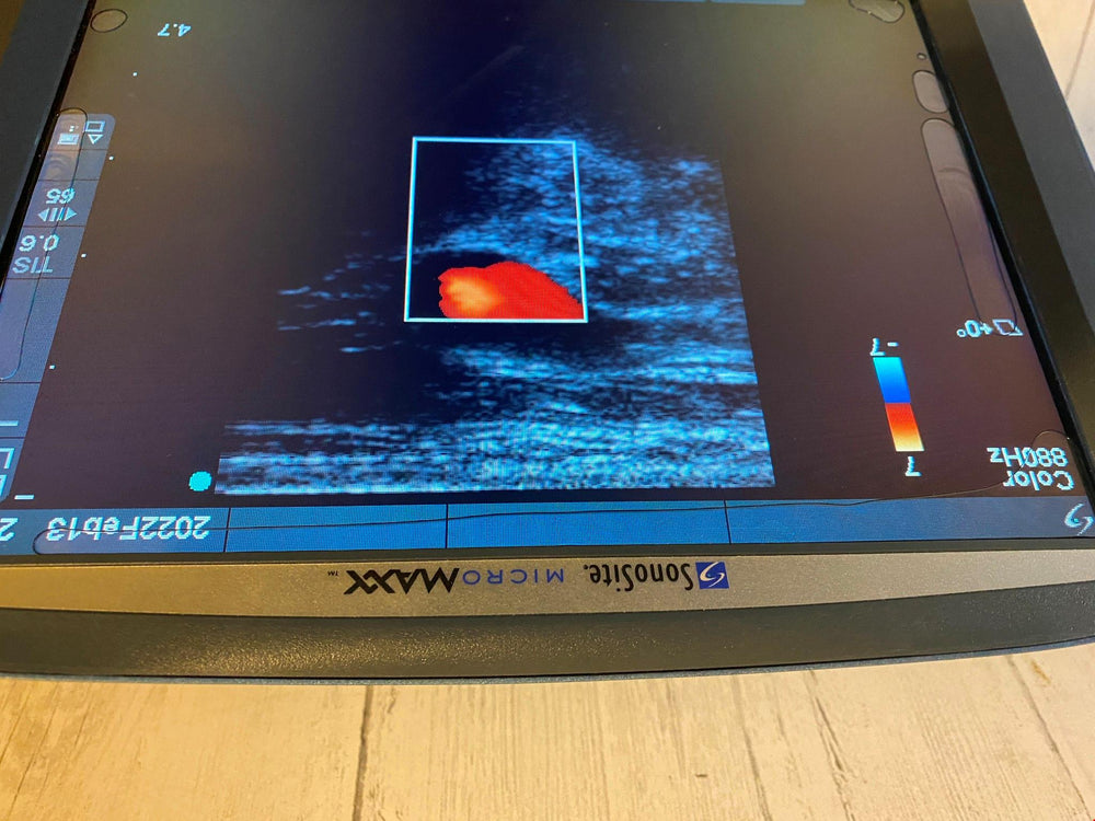 
                  
                    Sonosite MicroMaxx Portable Ultrasound 2007- Main unit
                  
                