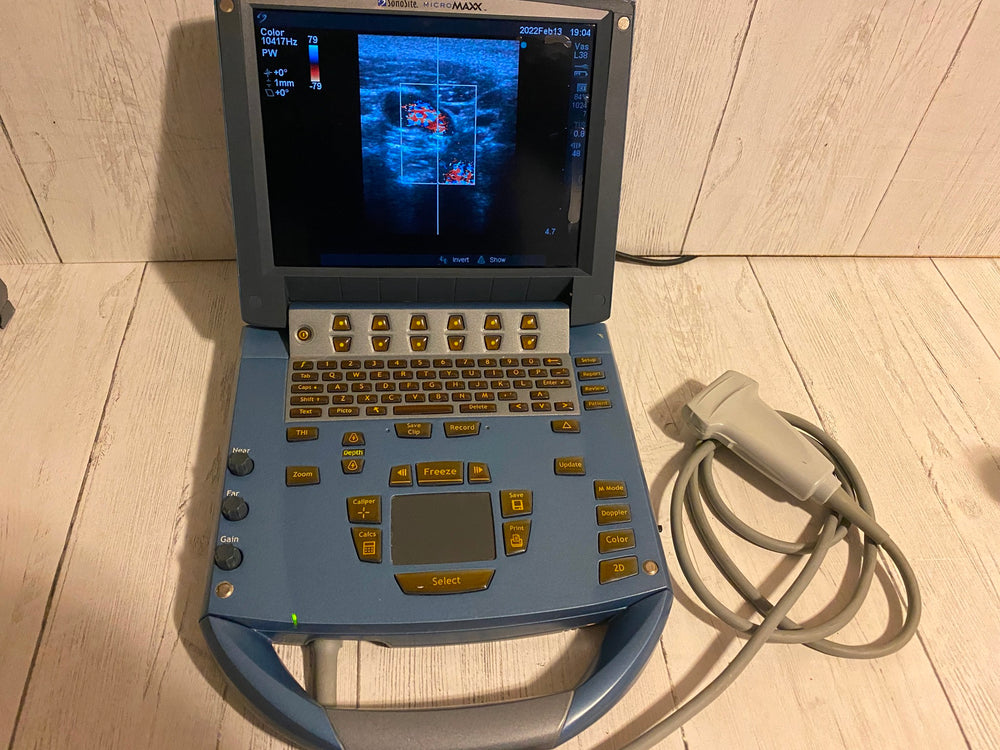 Sonosite MicroMaxx Portable Ultrasound 2005- Main unit For parts