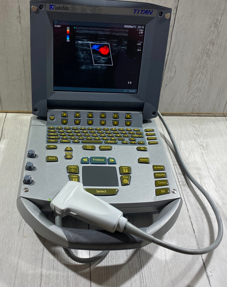 
                  
                    Sonosite Titan  Portable Ultrasound 2005 - With Linear array probe L25
                  
                
