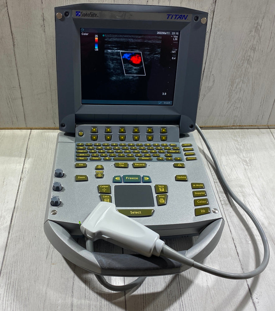 
                  
                    Sonosite Titan  Portable Ultrasound 2005 - With Linear array probe L25
                  
                