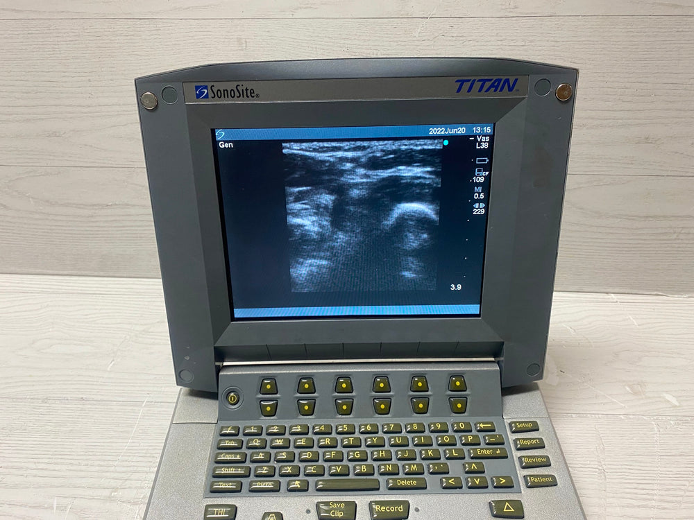 
                  
                    Sonosite Titan Portable Ultrasound -With Linear Array L38 and Convex C60 probes
                  
                