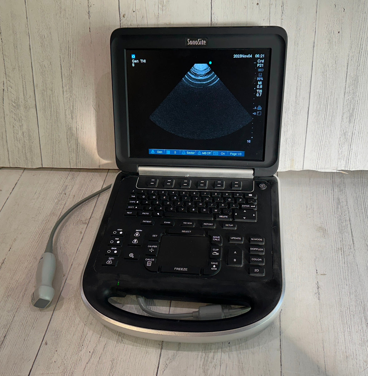 Sonosite Edge Portable Ultrasound & Phased Array Cardiac Probe P21x Wa ...