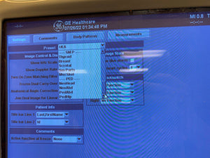
                  
                    GE LOGIQ 9 ULTRASOUND MACHINE WITH 3 PROBES (M12L, E8C, 9L) 2005
                  
                