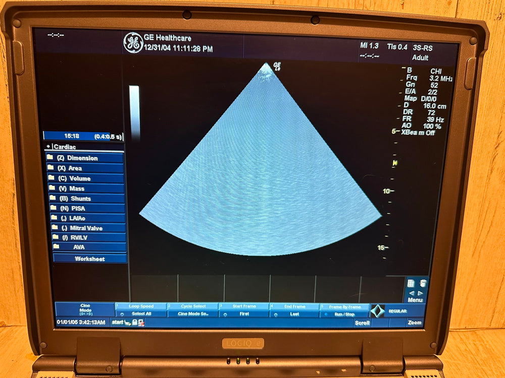 
                  
                    GE LOGIQ E Ultrasound 2006, Vascular, OBGYN, MSK
                  
                