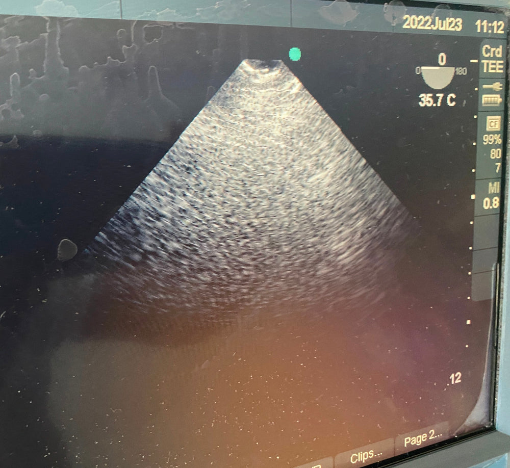 
                  
                    SONOSITE MICROMAXX ULTRASOUND TEE 8-3MHZ TRANSDICER PROBE  DOM 2007
                  
                