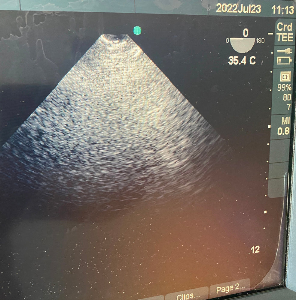 
                  
                    SONOSITE MICROMAXX ULTRASOUND TEE 8-3MHZ TRANSDICER PROBE  DOM 2007
                  
                