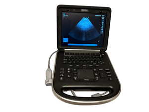 
                  
                    Sonosite Edge Portable Ultrasound 2015 & 3 probes P21x, P25x, C60x Refurbished
                  
                