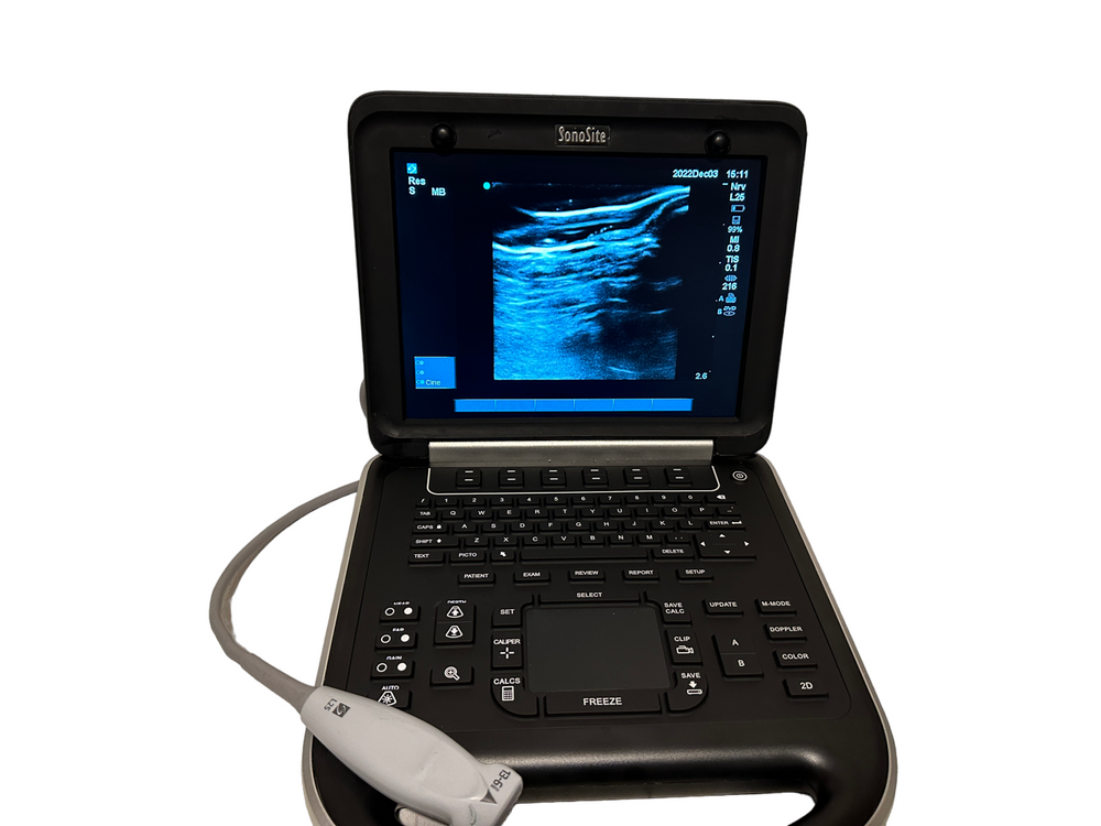 
                  
                    Sonosite Edge Portable Ultrasound 2015 & 3 probes P21x, P25x, C60x Refurbished
                  
                
