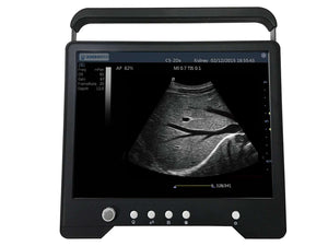 
                  
                    iSonoTouch 20V
                  
                