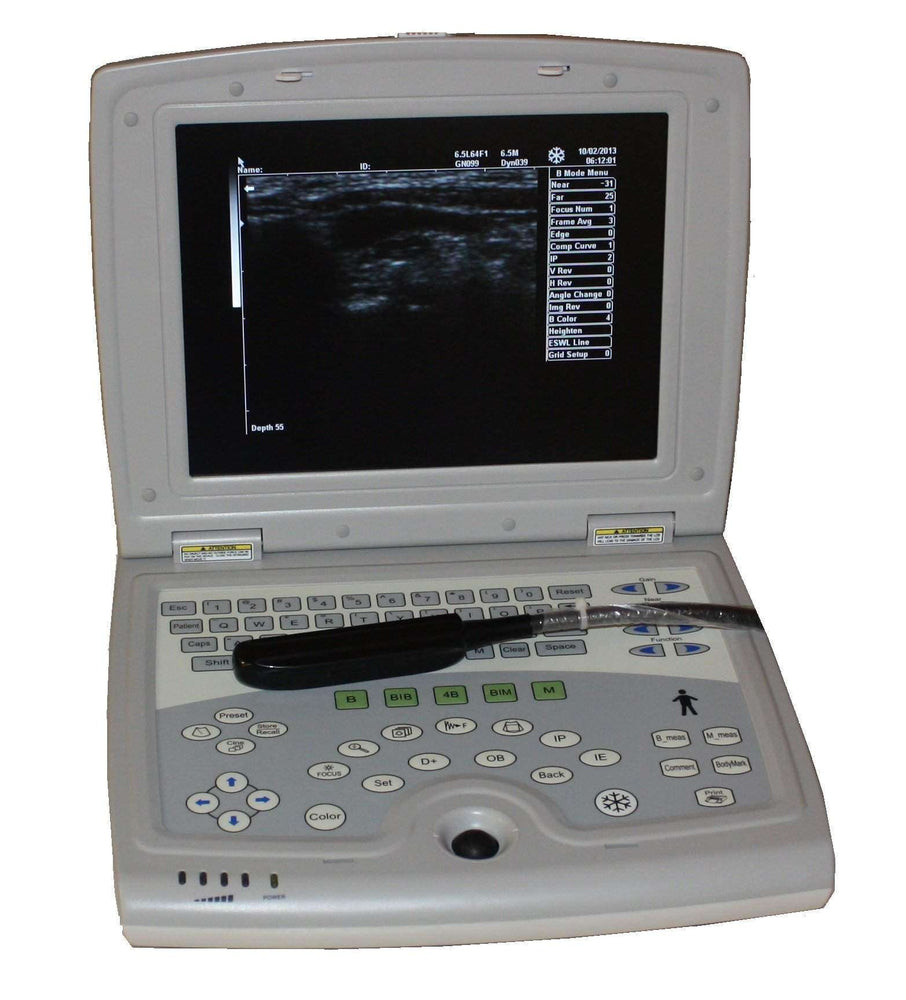 
                  
                    KX5000V Veterinary Portable Laptop Ultrasound Machine | KeeboMed
                  
                