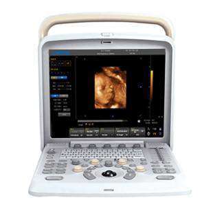 
                  
                    Chison Q5 Portable Ultrasound Machine 
                  
                