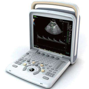 
                  
                    Chison Q6 Ultrasound Machine | KeeboMed
                  
                