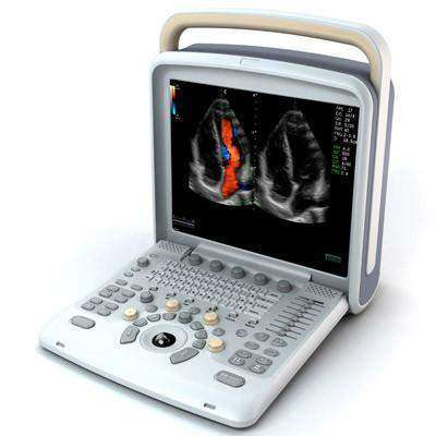 Chison Q6Vet Color Doppler Veterinary Ultrasound | KeeboMed