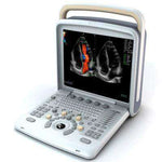 Chison Q6 Ultrasound Machine | KeeboMed