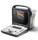 SonoScape S6 Color Doppler Portable Ultrasound | KeeboMed