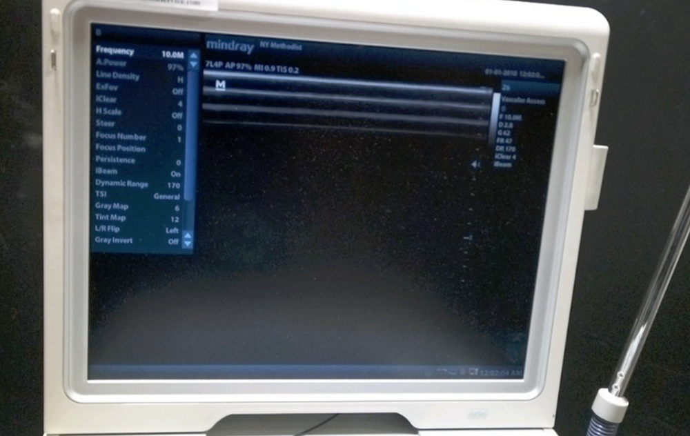 
                  
                    MINDRAY Z6 Ultrasound Machine with One Linear Array Probe (7L4P) 2014
                  
                
