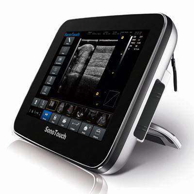 Chison Sonotouch 10Vet Full Touchscreen Ultrasound | KeeboMed