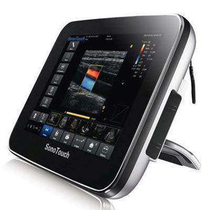 
                  
                    Chison Sonotouch 30 Touch Screen Ultrasound | KeeboMed
                  
                