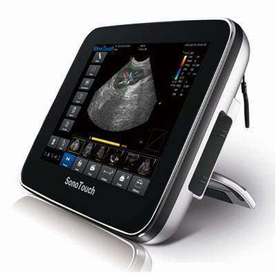 Chison Sonotouch 20Vet Color Touchscreen Ultrasound | KeeboMed
