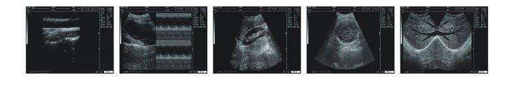 
                  
                    almheld veterinary animal ultrasound scanner WED-3000Vet
                  
                