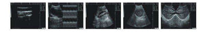 
                  
                    almheld veterinary animal ultrasound scanner WED-3000Vet
                  
                