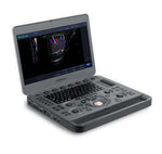 SonoScape X5 Lightweight Laptop Color Doppler Ultrasound System | KeeboMed